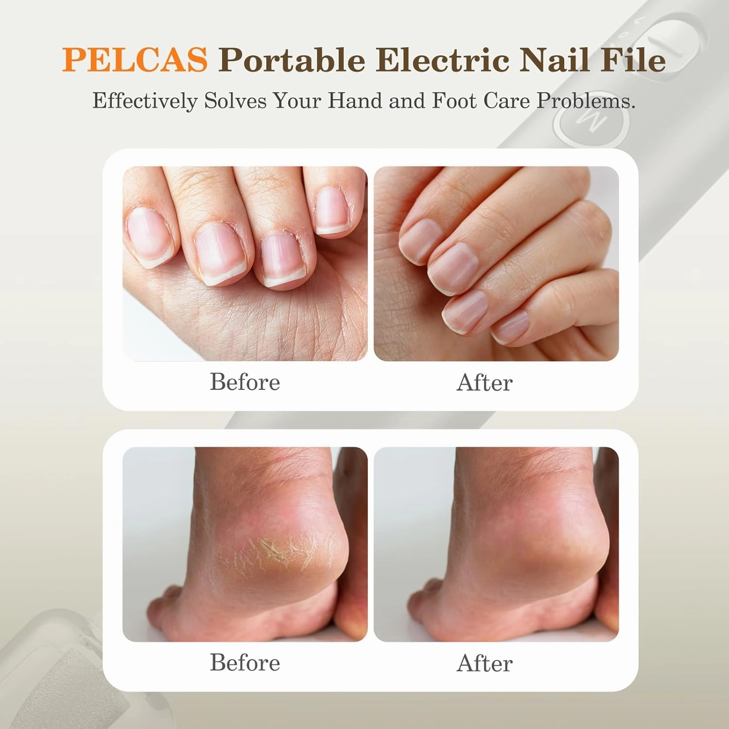 PELCAS Electric Nail Grinder, 10 Speeds Cordless Nail Drill with LED Light, Portable Manicure and Pedicure Kit, Nail File with LCD Screen for Human, Pet, Thick Toenails, Natural & Acrylic Nails Grey